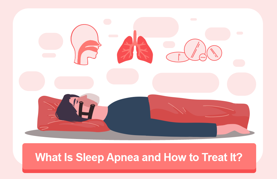 What Is Sleep Apnea and How to Treat It?